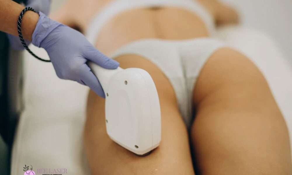 Prepare for Laser Hair Removal Treatment in Harrow?