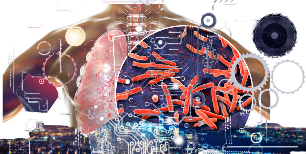 Tuberculosis (TB) in the Digital Health today