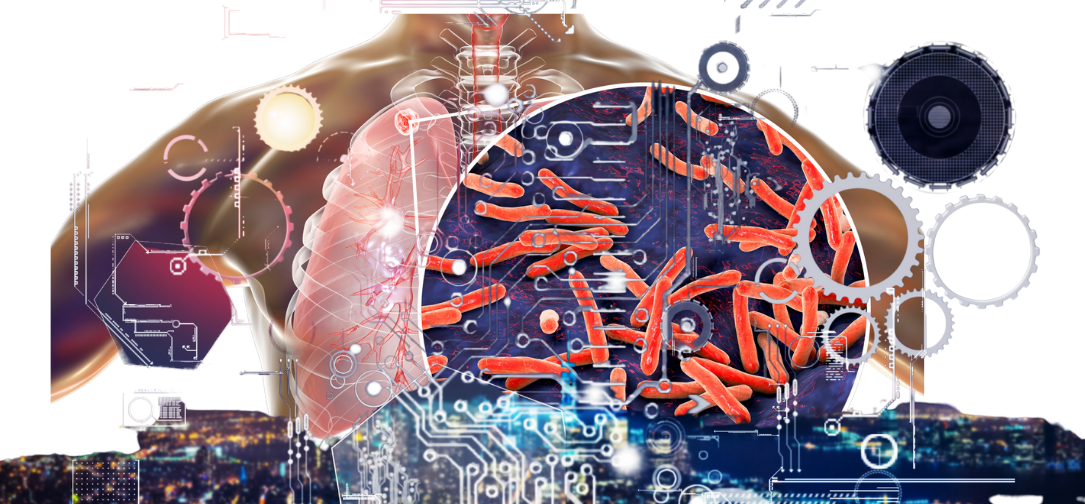 Tuberculosis (TB) in the Digital Health today