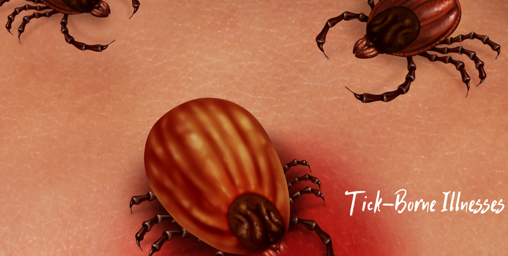 The Rising Threat of Tick-Borne Illnesses