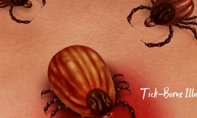 The Rising Threat of Tick-Borne Illnesses